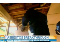 Doorbraak in behandeling van asbestgerelateerde kanker